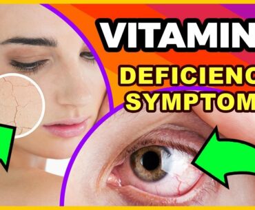Vitamin A deficiency - Skin, Immunity & Eyes Problems (Symptoms & Food) in HINDI