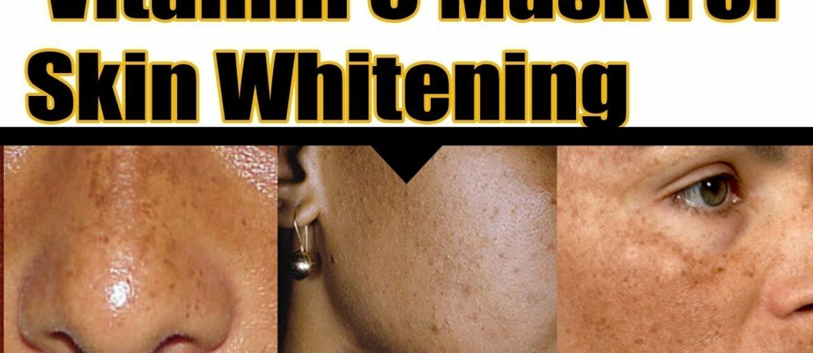 Skin Brightening - Vitamin C Face Mask // for Spotless fair skin DR. MANOJ DAS