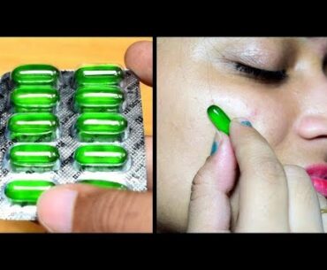 5 Magical Beauty HACKS Using Vitamin E - Pimples, Dark Spots, Pink Lips Dark Circles | No TOOTHPASTE