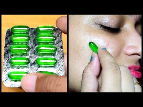 5 Magical Beauty HACKS Using Vitamin E - Pimples, Dark Spots, Pink Lips Dark Circles | No TOOTHPASTE