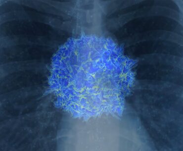 How COVID-19 Turns Your Immune System Against You