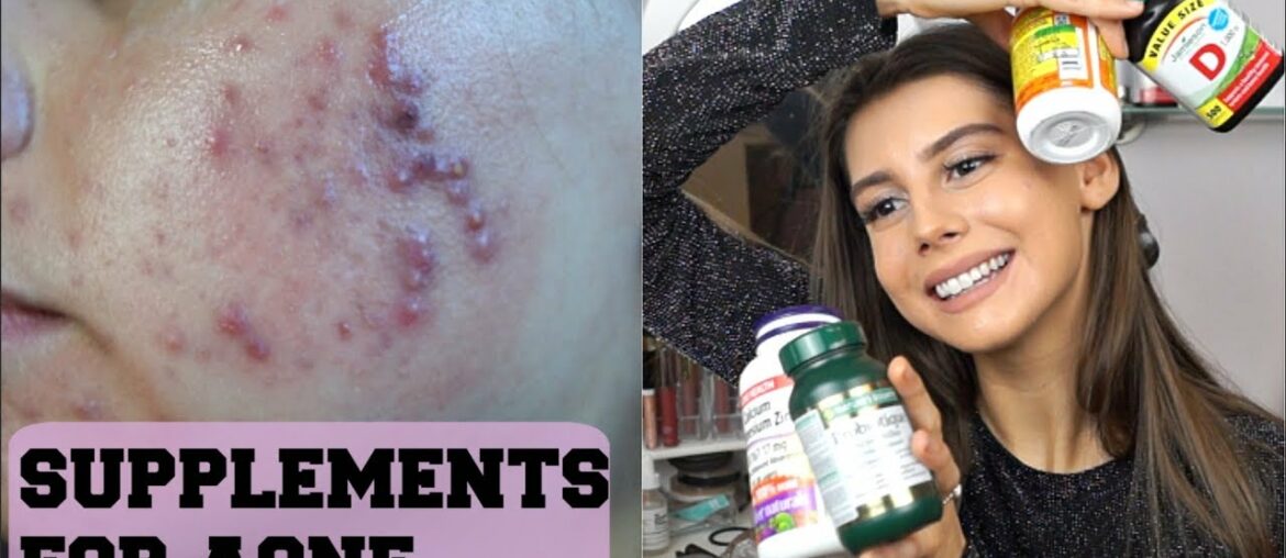 SUPPLEMENTS I TAKE FOR FLAWLESS SKIN AND ACNE|| Vitamin D, Zinc, Probiotics, Charcoal and more!