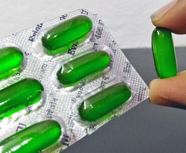 4 VITAMIN E CAPSULE SIMPLE TRICKS- EASY DIY LIFE HACKS | Awesome Beauty Ideas- Simple Tricks hacks