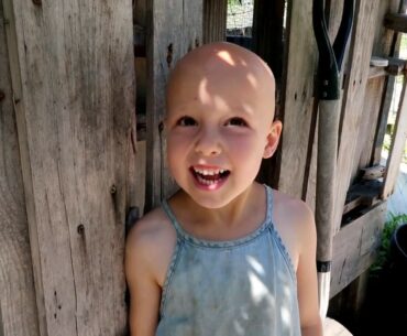 How To Get FREE Vitamin D and Healing For Autoimmune Alopecia