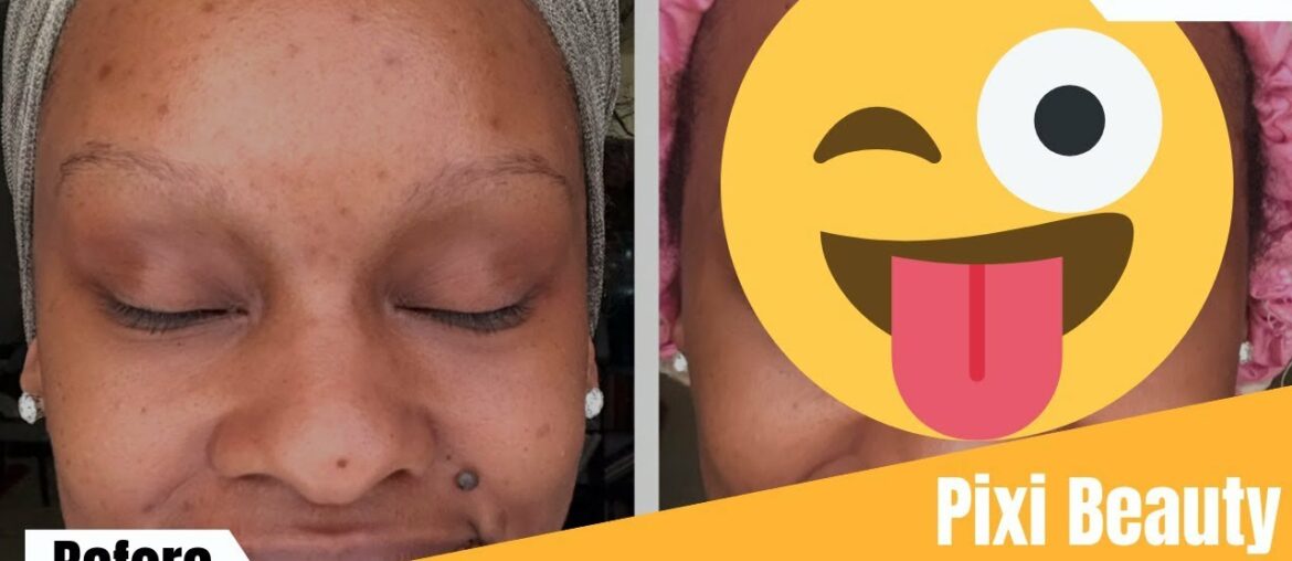 Vitamin C Skincare 30 Day Review | Pixi Beauty | SkinTreats Collection