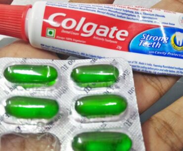 Natural Beauty Hacks For Remove Pimples Overnight | Vitamin E Capsule Colgate Toothpaste Beauty tips