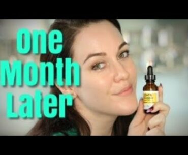 MAD HIPPIE VITAMIN C SERUM...ONE MONTH LATER!🍊📆💎