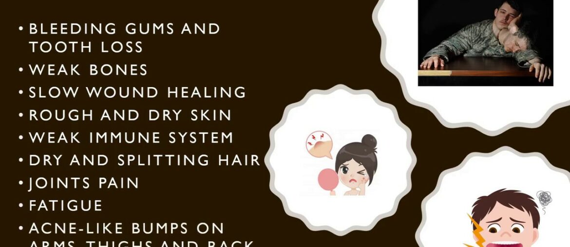 How to improve Immune System with VITAMIN C | Handpicked OFNI