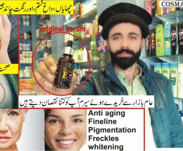 vitamin c serum | best serum for acne scars | face veins | honest beauty reviews | اصل سیرم
