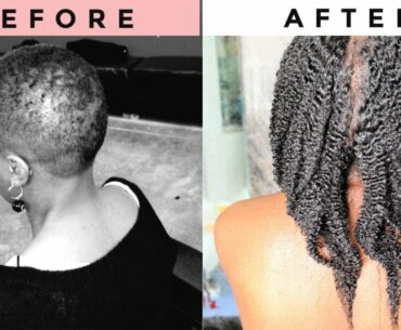 Vitamins For Hair Growth/ Hair Loss/ Thinning Hair - Supplements For Natural Hair