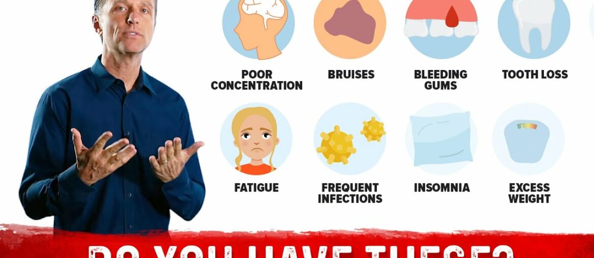 4 Subclinical Vitamin C Deficiency Signs that are Extremely Common