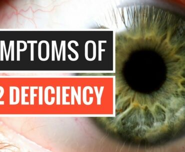5 Signs and Symptoms of Vitamin B12 Deficiency