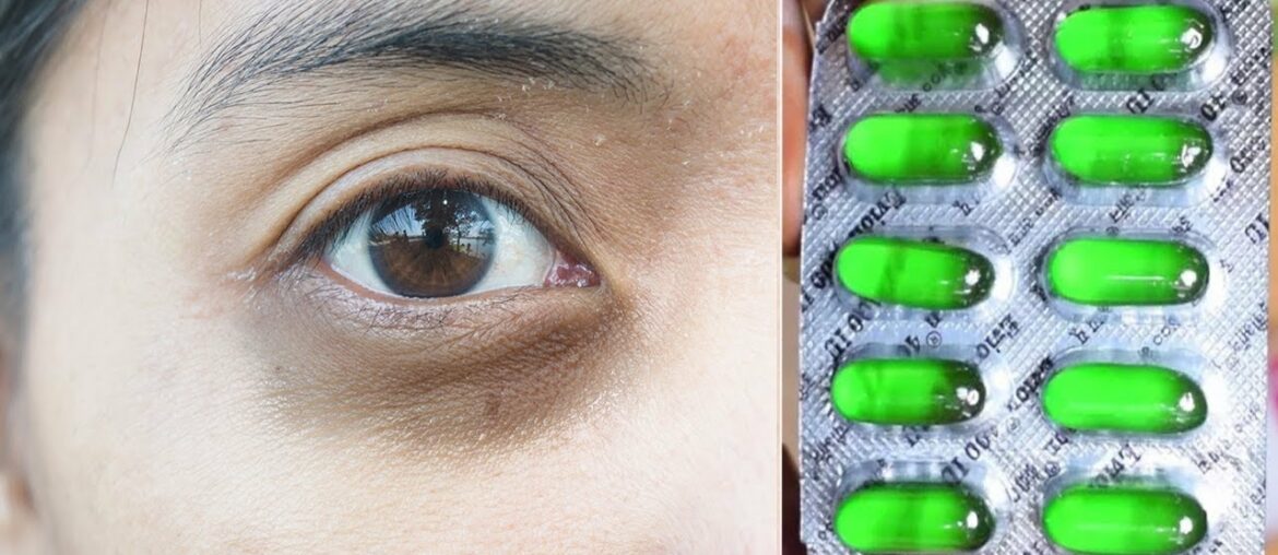 Apply It Just Every Night | Remove DARK CIRCLES Overnight with Vitamin E