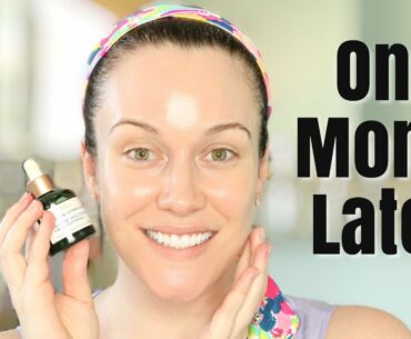 DID IT WORK?! 🤔ONE MONTH LATER!📆 BIOSSANCE SQUALANE + VITAMIN C ROSE OIL 🌹🍊