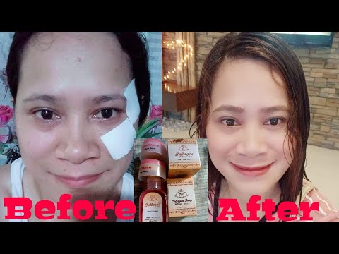 Collagen Vitamin C and E || Beauty Secret ni Inday