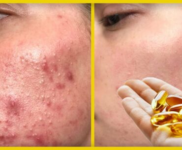 Vitamin E Oil for Skin & Hair | Complete Uses with Benefits | Beauty Tips in Urdu