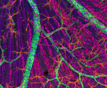 ∆° VItamin A Hz - C20H30O - Vision, Immune System, Retinol, - Binaural Tones