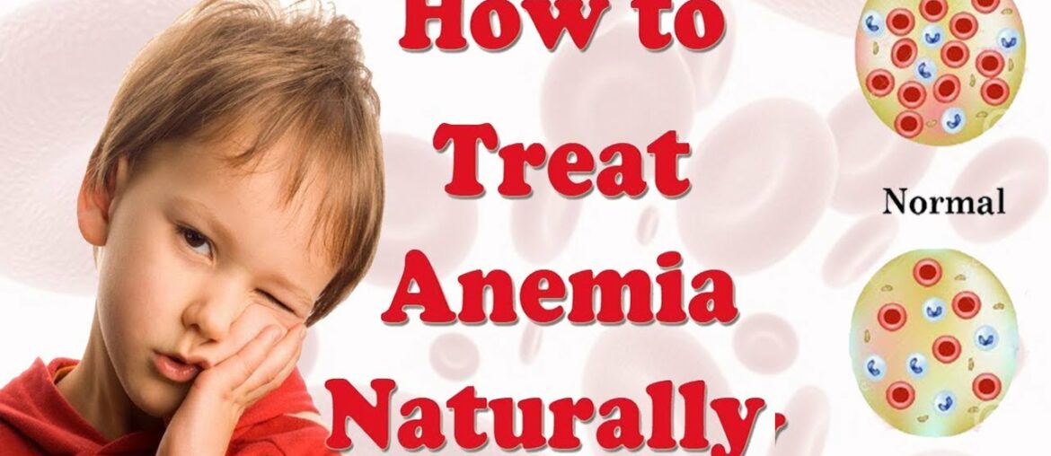How to Treat Anemia Naturally at Home || Home Remedies for Anemia || Iron Deficiency