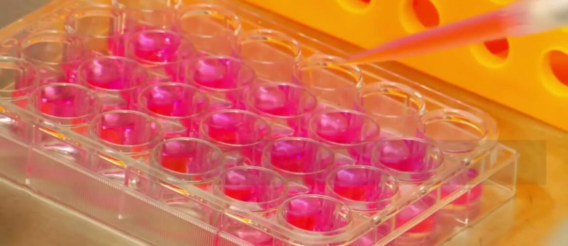 How Vitamin D Supports Your Immune System