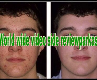 7. Acnetame Vitamin Supplements – Keep Your Skin Clear from Inside