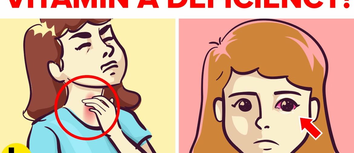 5 Hidden Signs Of Vitamin A Deficiency You Should Not Ignore