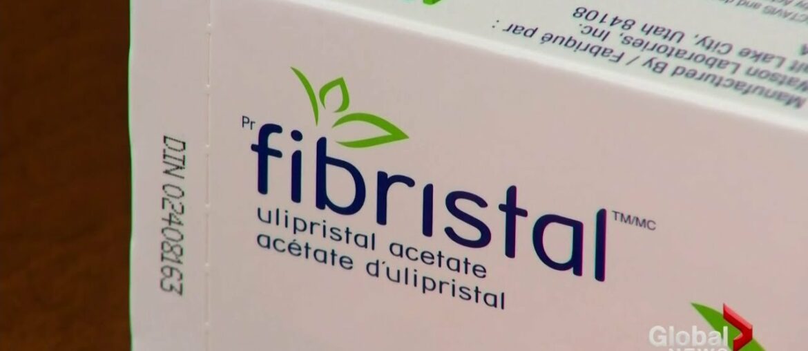 New fibroids drug treatment