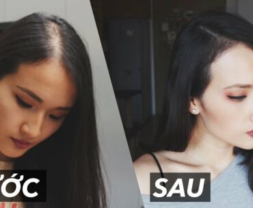 CÁCH MÌNH GIẢM RỤNG TÓC & KÍCH THÍCH MỌC TÓC | Chuyện làm đẹp | Giang Ơi