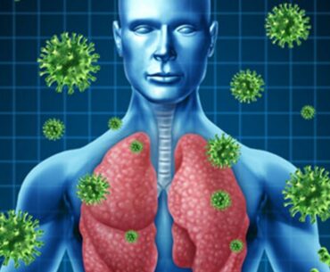 12 Home Remedies To Treat Viral Infections & Boost Immune Response