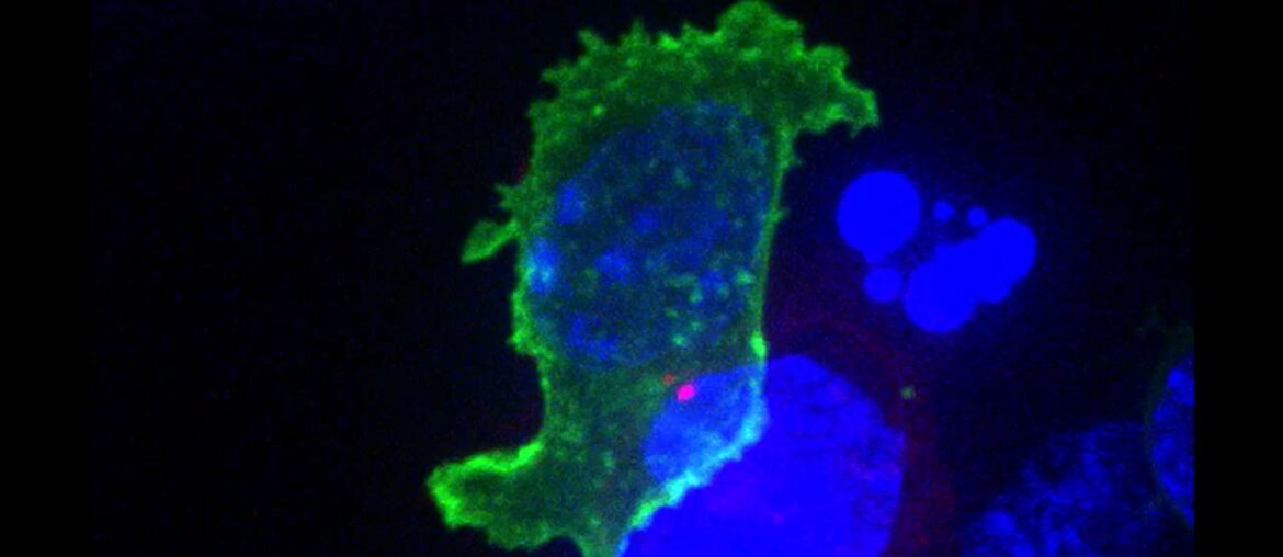 Killer T cell attacking cancer
