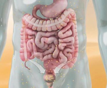 Die Grosse Wirkung der Vitamin-C-Hochdosis-Infusion