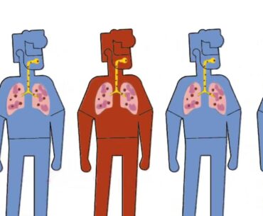 Immunity against COVID-19 with Vitamin D (Hindi)
