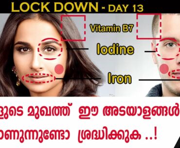 | ഈ അടയാളങ്ങൾ ശ്രദ്ധിക്കുക | Vitamin Deficiency |Certified Fitness Trainer Bibin