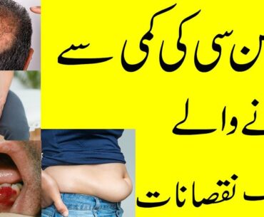 Vitamin C ki Kami ke Nuksanat | How to get vitamin C | Vitamin C Deficiency