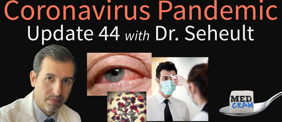 Coronavirus Pandemic Update 44: Loss of Smell & Conjunctivitis in COVID-19, Is Fever Helpful?