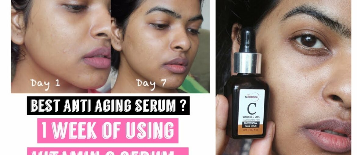 1 Week of Using Vitamin C Serum Challenge || Ft. StBotanica Vitamin C Facial Serum