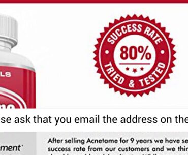 Acnetame - Vitamin Supplements for Acne Treatment - 60 Natural Pills