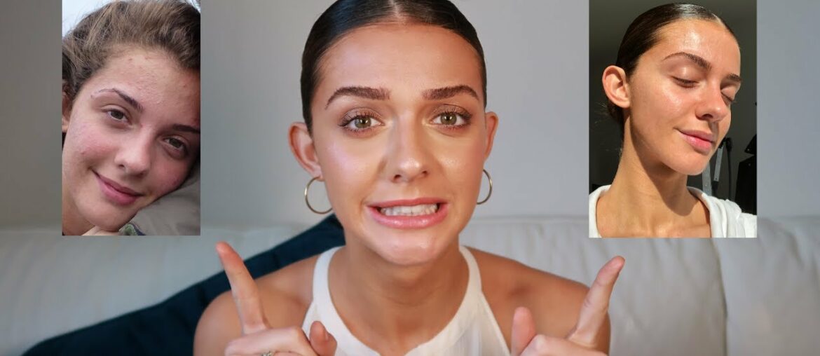 PREVENTING ACNE AND AGEING: CURRENT SKINCARE ROUTINE