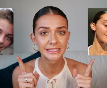 PREVENTING ACNE AND AGEING: CURRENT SKINCARE ROUTINE