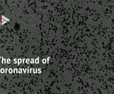 Under the microscope: Here's what the coronavirus looks like