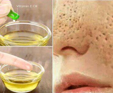 Skin Whitening Vitamin E At Home Remedies| 2020 Beauty Secrets