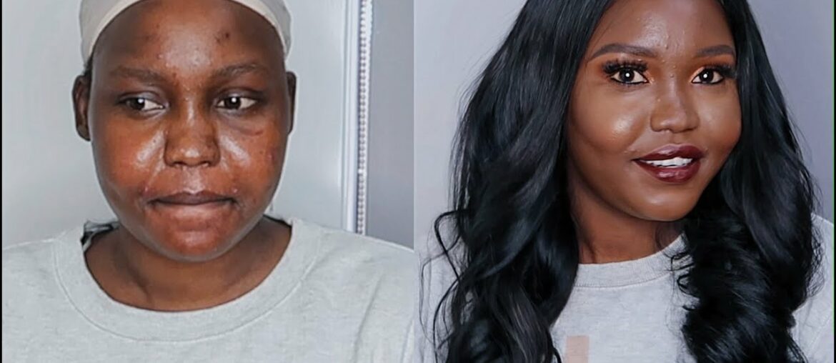 HOW TO COVER UP BLEMISHES/ ACNE USING MINIMUM PRODUCTS