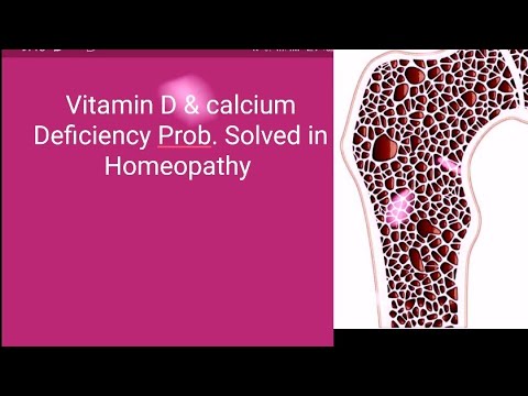 Vitamin D and Calcium deficiency cure by Homeopathy