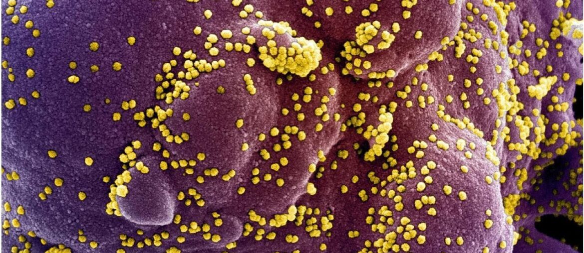 Vitamin D: The Secret to Protecting Yourself from COVID-19?