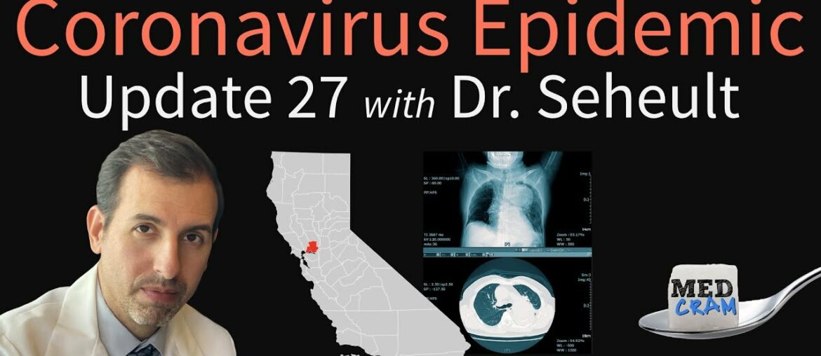 Coronavirus Epidemic Update 27: Testing accuracy for COVID-19 (CT Scan vs. RT-PCR), California Cases
