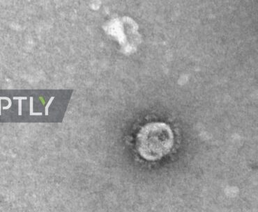Russia: Scientists 'take first microscope images' of new coronavirus