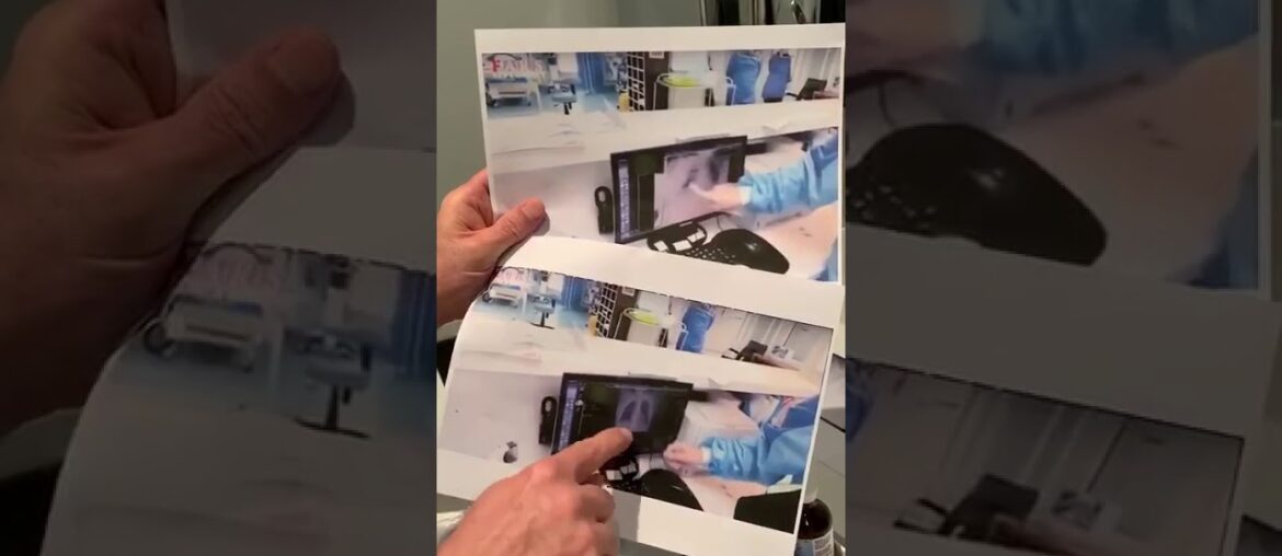 Coronavirus -Iranian doctors successfully treating Coronavirus patients by using vitamin C