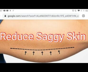 Reduce Saggy Skin