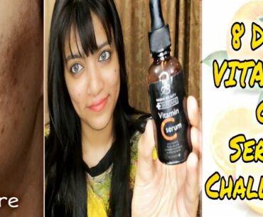 How to use VITAMIN C serum | I used VITAMIN C serum for a week and this happened |
