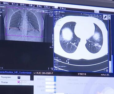 Applying 5G to remote CT scans on COVID-19 cases