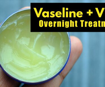 Vaseline With 1 Vitamin E Capsule Can Change Your Skin Overnight